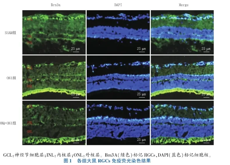 Immunofluorescence staining results of RGCs in each group of rats Immunofluorescence staining results of RGCs in each group of rats